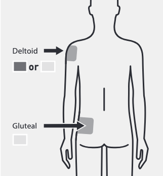 Diagram of injection location options.