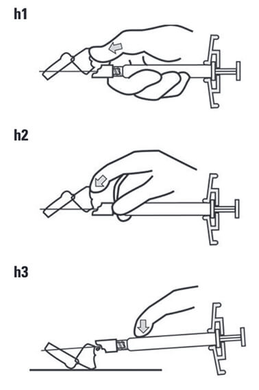 Diagram of person activating the needle protection system.